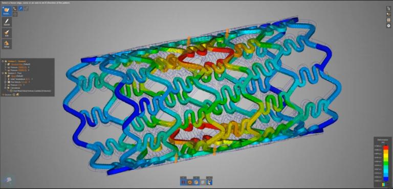 Nghiên cứu về sự biến dạng của một stent cho thấy những phản hồi tích cực về hiệu suất.