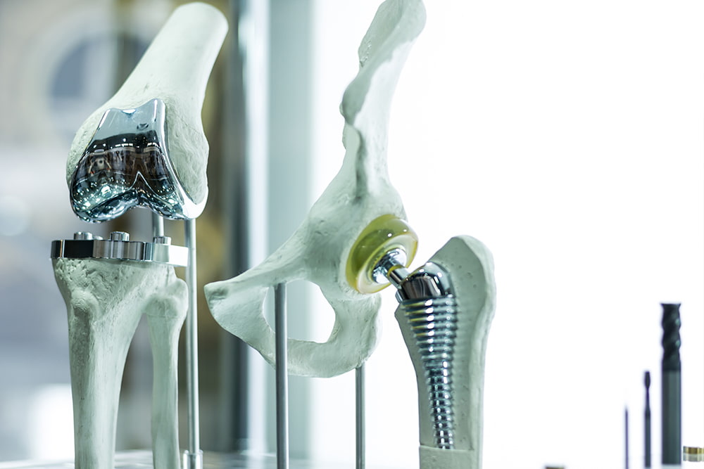 Chân giả và khớp nối kim loại được tạo bằng công nghệ in 3D