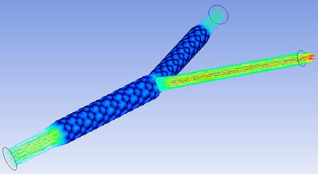 Các véc tơ vận tốc chỉ rõ vận tốc giảm trong các nhanh stent của một động mạch vành