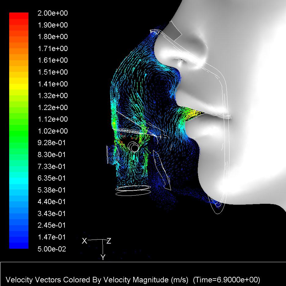 Vector vận tốc trong quá trình hít vào.