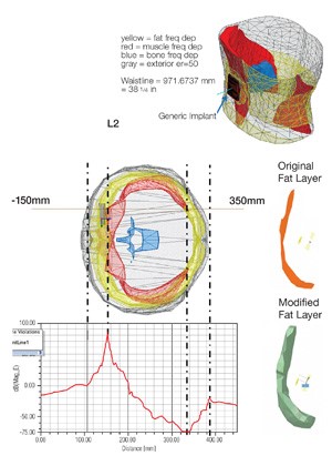 Mô hình cơ thể người trong ANSYS HFSS