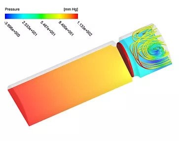 Mô phỏng ghép nối 0D-3D. Biểu đồ đồng mức áp suất cùng với đường dòng áp suất trong quá trình co (trái) và giãn (phải) của tâm thất và tim